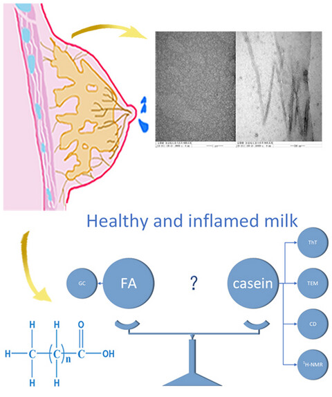 Amyloid fibril formation by casein and fatty acid composition in breast milk of mastitis patients