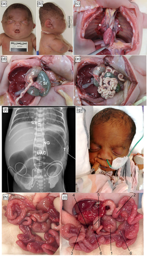Details are in the caption following the image Details are in the caption following the image