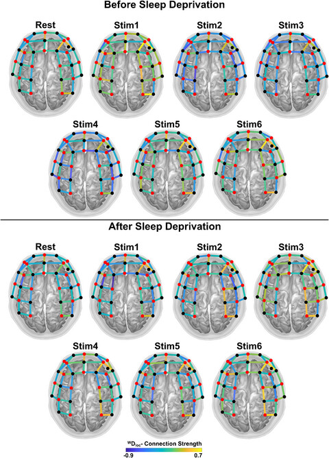 Sleep deprivation alters task-related changes in functional connectivity of the frontal cortex: A near-infrared spectroscopy study