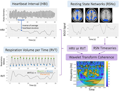 Characterizing systemic physiological effects on the blood oxygen level dependent signal of resting-state fMRI in time-frequency space using wavelets