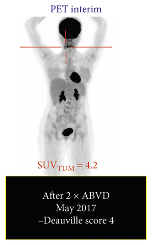Details are in the caption following the image