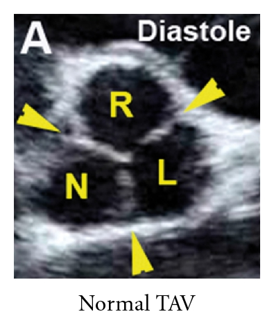 Details are in the caption following the image