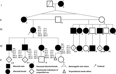 Polyglandular syndrome type 2 in a Mexican family and its association with human leukocyte antigen