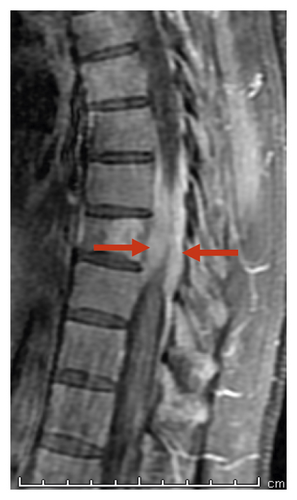 Details are in the caption following the image