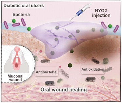 A Natural Eumelanin-Assisted Pullulan/Chitosan Hydrogel for the Management of Diabetic Oral Ulcers