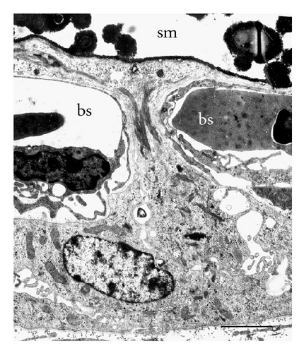 Details are in the caption following the image