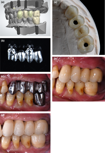 Details are in the caption following the image Details are in the caption following the image