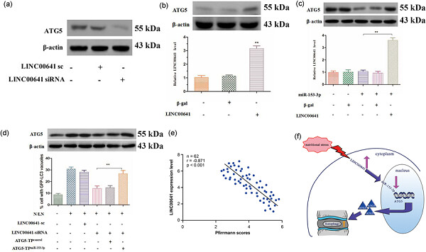 LINC00641 regulates autophagy and intervertebral disc degeneration by acting as a competitive endogenous RNA of miR-153-3p under nutrition deprivation stress