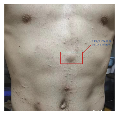 Details are in the caption following the image