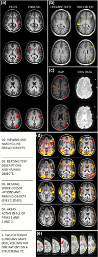 Details are in the caption following the image Details are in the caption following the image