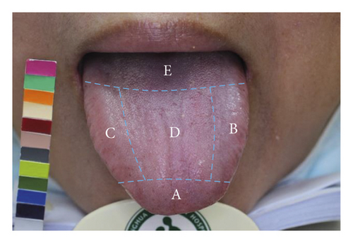 Details are in the caption following the image Details are in the caption following the image