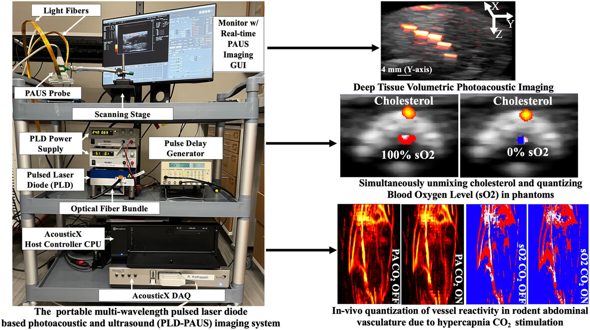 Multiwavelength laser diode based portable photoacoustic and ultrasound imaging system for point of care applications