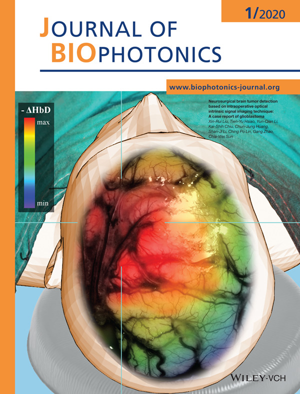 Inside Front Cover: Neurosurgical brain tumor detection based on intraoperative optical intrinsic signal imaging technique: A case report of glioblastoma (J. Biophotonics 1/2020)