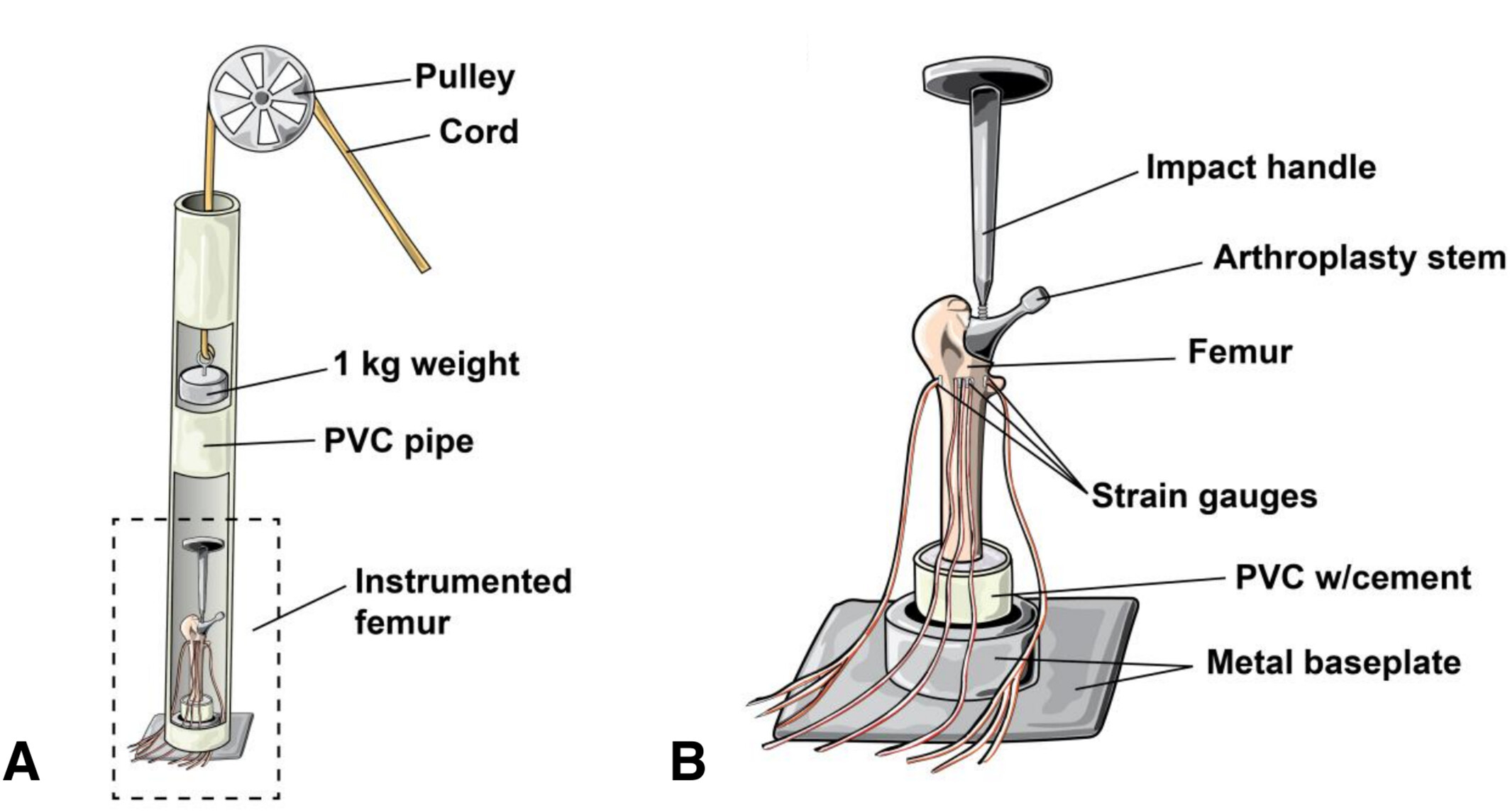 Total Hip Arthroplasty Stems and Femur Strain During Implant Insertion: A Biomechanical Study of Single Taper, Double Taper, and Collared Monolithic Stems Issue ,