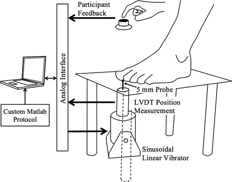 Vibrotactile sensitivity of patients with HIV-related sensory neuropathy: An exploratory study