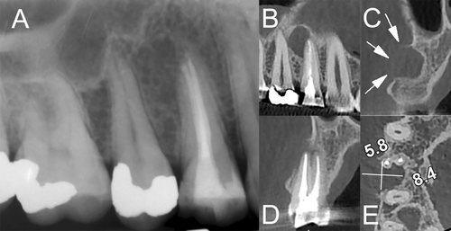 Details are in the caption following the image Details are in the caption following the image