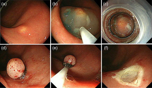Details are in the caption following the image Details are in the caption following the image