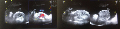 Details are in the caption following the image Details are in the caption following the image