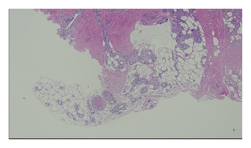 Details are in the caption following the image