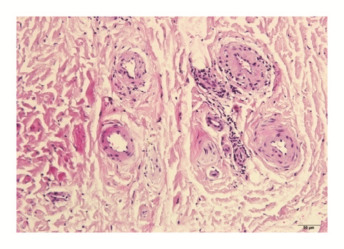 Details are in the caption following the image