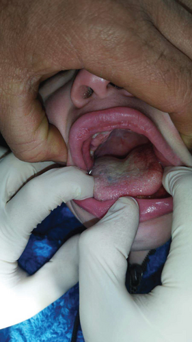 Details are in the caption following the image Details are in the caption following the image