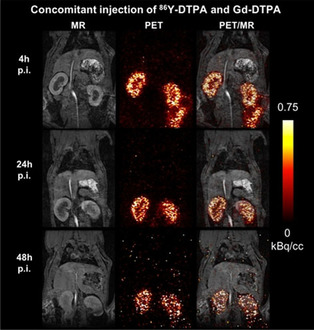 Yttrium-86 Is a Positron Emitting Surrogate of Gadolinium for Noninvasive Quantification of Whole-Body Distribution of Gadolinium-Based Contrast Agents
