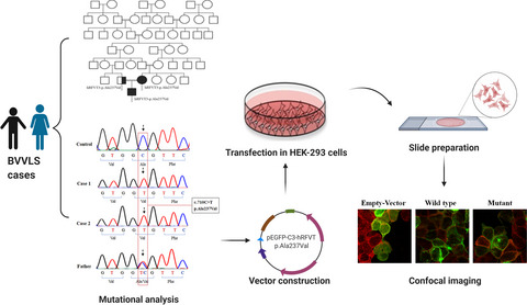 Brown−Vialetto−Van Laere and Fazio−Londe syndromes: SLC52A3 mutations with puzzling phenotypes and inheritance