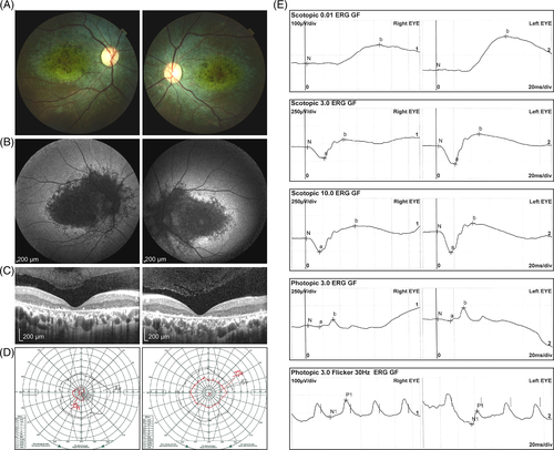 Details are in the caption following the image Details are in the caption following the image
