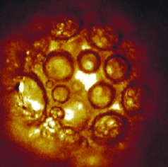 Vesicular Latex