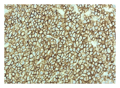 Details are in the caption following the image