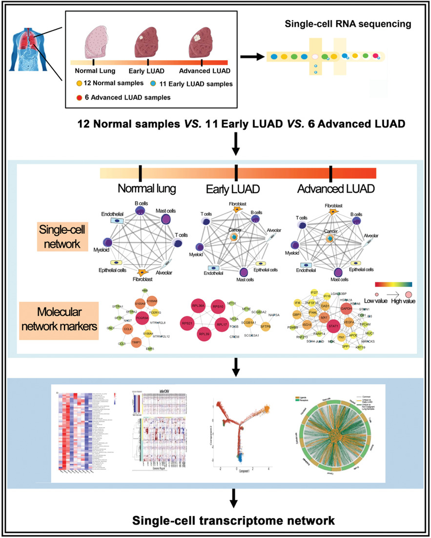Landscape and dynamics of single tumor and immune cells in early and advanced-stage lung adenocarcinoma