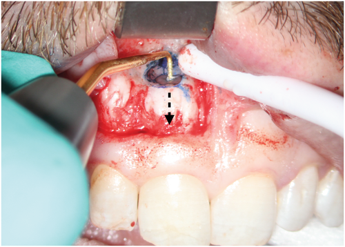 Details are in the caption following the image Details are in the caption following the image