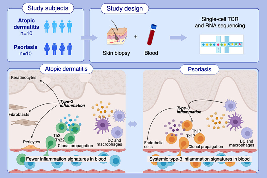 Single-cell profiles reveal distinctive immune response in atopic dermatitis in contrast to psoriasis