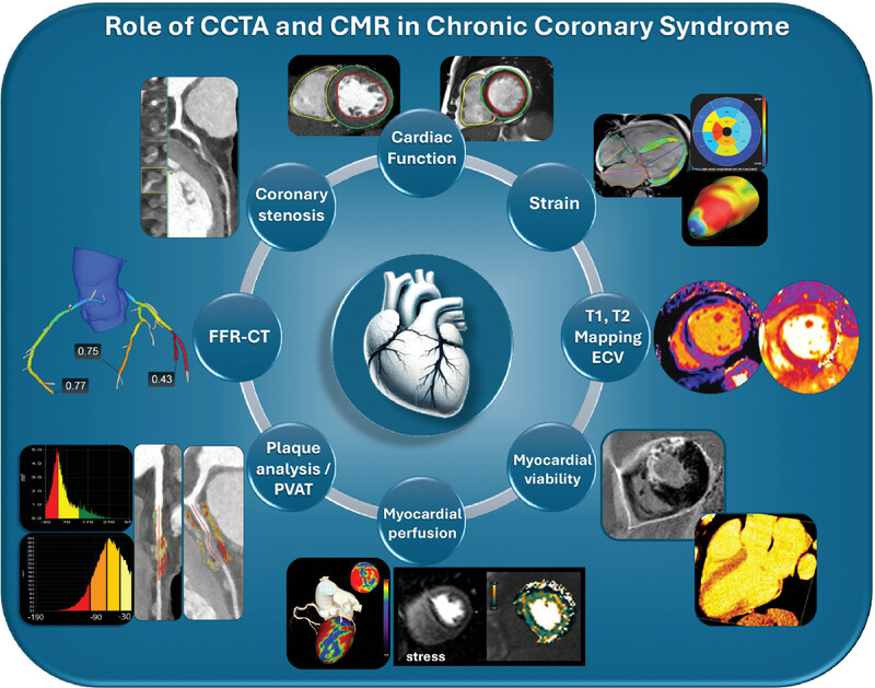 Role of CT and CMR in the Management of Chronic Coronary Syndrome