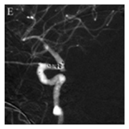 Details are in the caption following the image