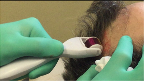 Details are in the caption following the image Details are in the caption following the image