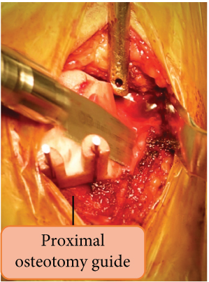 Details are in the caption following the image Details are in the caption following the image