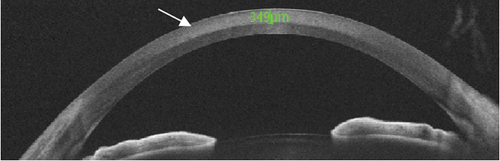 Details are in the caption following the image