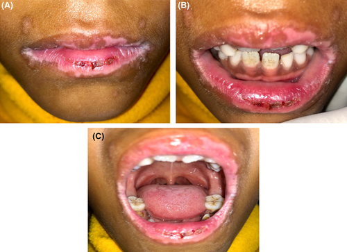 Details are in the caption following the image Details are in the caption following the image