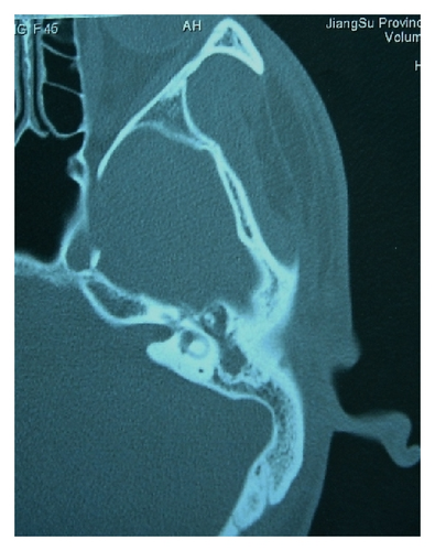 Details are in the caption following the image