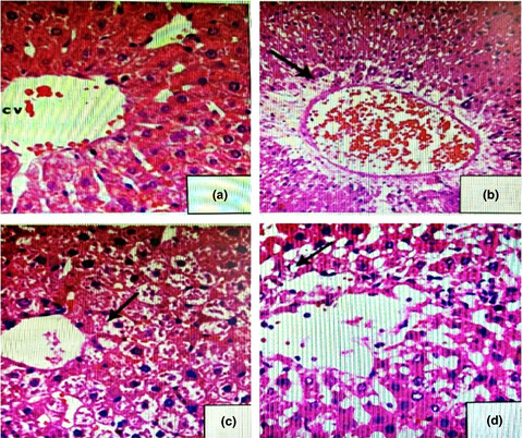 Evaluation of Nano-curcumin effects against Tartrazine-induced abnormalities in liver and kidney histology and other biochemical parameters