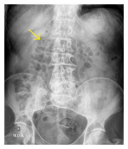 Details are in the caption following the image Details are in the caption following the image