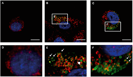 Localization of the anti-cancer peptide EGFR-lytic hybrid peptide in human pancreatic cancer BxPC-3 cells by immunocytochemistry