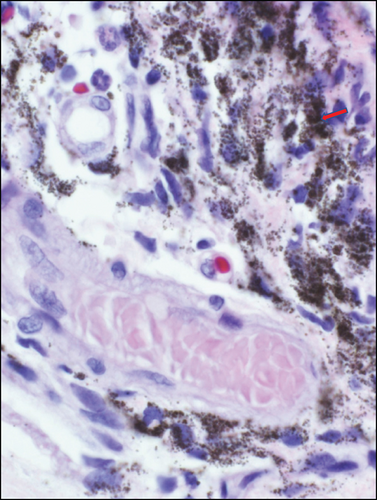 Details are in the caption following the image Details are in the caption following the image