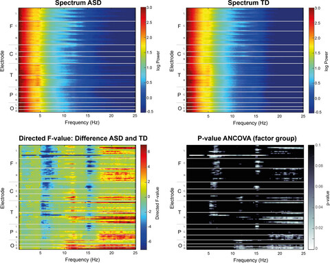 Nonrapid eye movement sleep and risk for autism spectrum disorder in early development: A topographical electroencephalogram pilot study