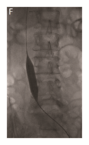 Details are in the caption following the image
