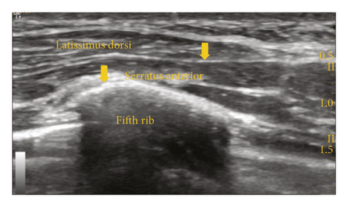 Details are in the caption following the image