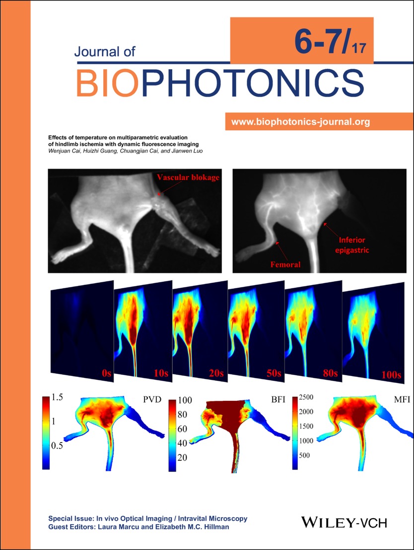 Inside Back Cover: Effects of temperature on multiparametric evaluation of hindlimb ischemia with dynamic fluorescence imaging (J. Biophotonics 6-7/2017) Volume 10 Issue 6-7, 2017