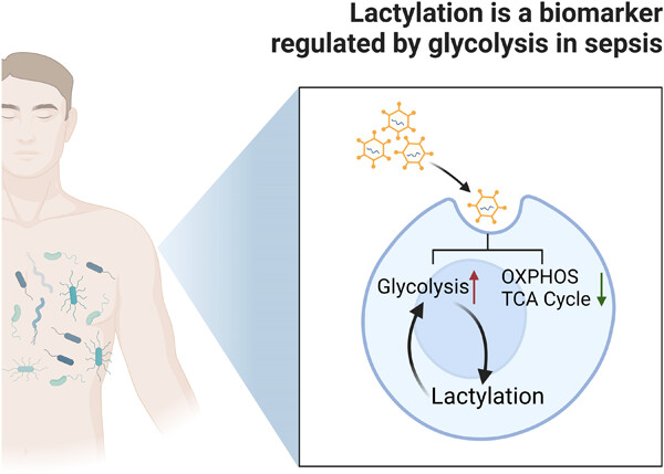 Potential biomarker for diagnosis and therapy of sepsis: Lactylation