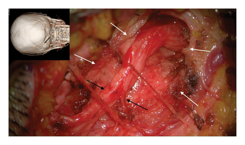 Details are in the caption following the image Details are in the caption following the image